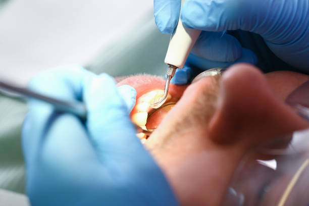 Best Urgent Dental Care for Toothache in Coalgate, OK